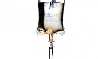 This Is a Hangover Cure, and It Is Awesome Feeling poorly? See the IV Doc.