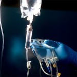 How Long Do IV Fluids Stay in the Body?