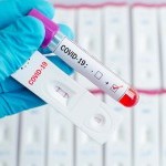 Where to Get Same Day Results Covid Test
