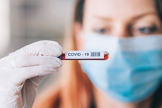 COVID-19 Antibody Testing (S-Protein)