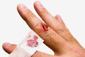Laceration repair - finger(s), toe(s), hand, foot