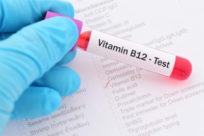 B12 for Hangover: The Best Way To Take Vitamin B12