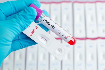 Where to Get Same Day Results Covid Test